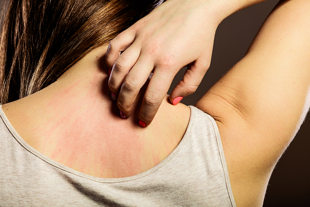 Stress can cause the skin barrier to be weak and can cause flares of eczema, itchy skin, and other problems like acne