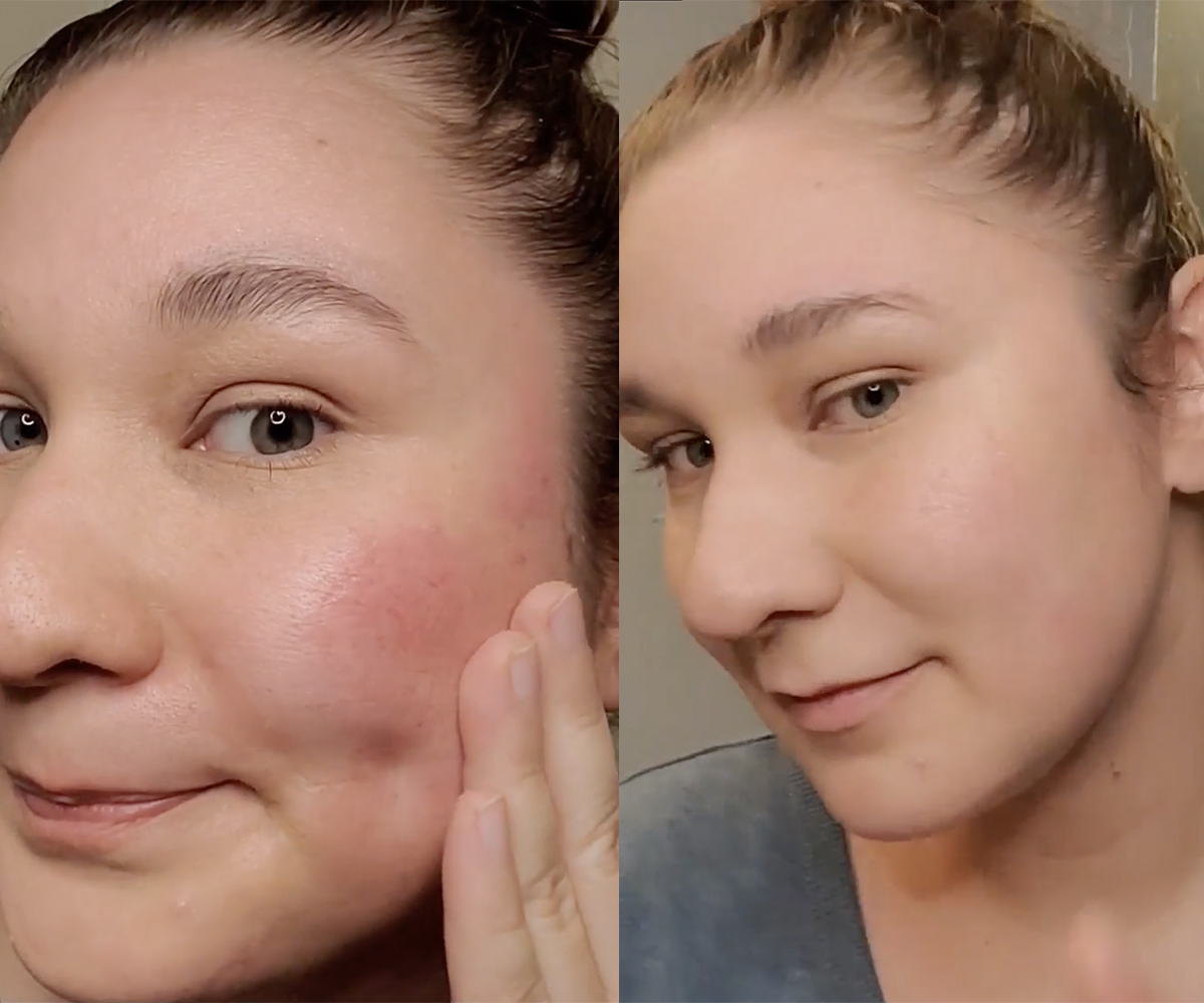 Anti-inflammatory mushroom Beta-glucans in skin care can benefit sensitive skin and reduce redness Anti-inflammatory mushroom Beta-glucans in skin care can benefit sensitive skin and reduce redness